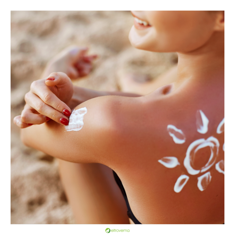 Sonnenbrand – was deine Haut jetzt braucht